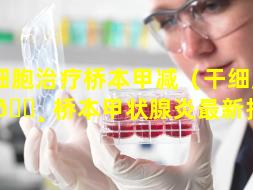 干细胞治疗桥本甲减（干细胞治疗 🕸 桥本甲状腺炎最新报道）
